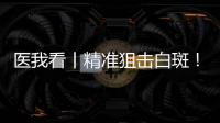 医我看丨精准狙击白斑
！这款“港澳药械通”白癜风新药开出澳珠首方