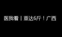 医我看丨重达6斤！广西女子乳腺肿瘤2年疯长至篮球大，医生提醒	：这些情况务必重视