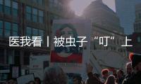 医我看丨被虫子“叮”上 �，发现“高烧和焦痂”？别大意
，这样急救�！