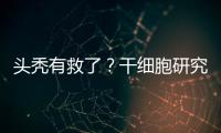 头秃有救了
？干细胞研究阐明压力如何影响毛发生长