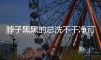 脖子黑黑的总洗不干净可能是病了，这些疾病信号赶紧自查